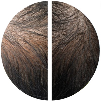 HR23+ hair growth supplement review before after customer 